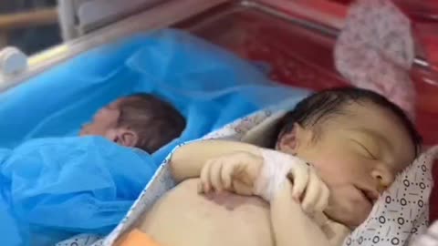 TWO CHILDREN DIED DUE TO MALNUTRITION TO AS A RESULT OF THE "ISRAELI" SIEGE IN NORTHERN GAZA