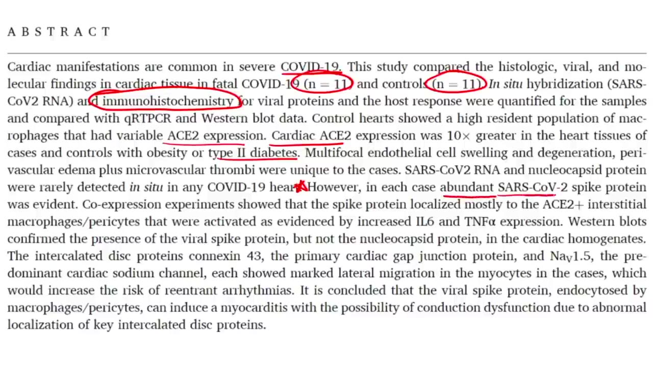 Encephalitis After COVID-19 Vaccine Administration: Perspectives