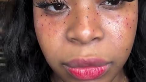 Woman Gets Tattoo of Freckles on Her Face