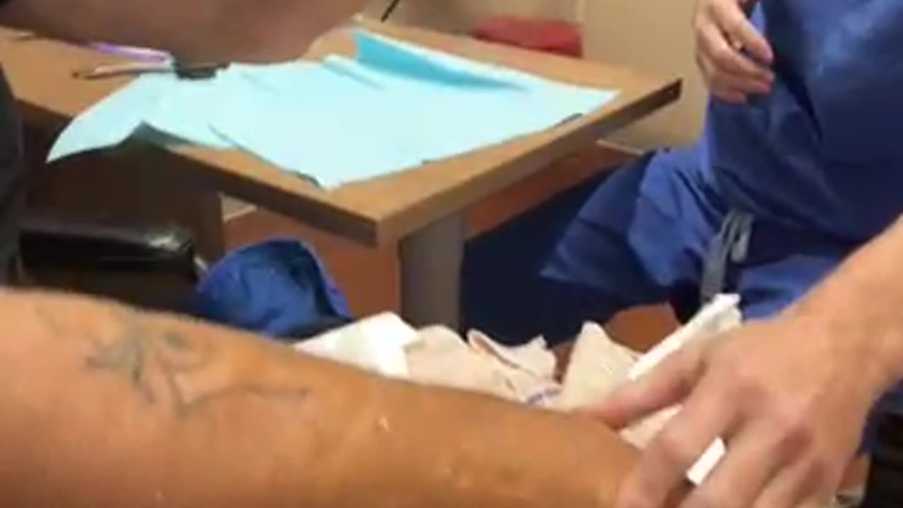Stitches