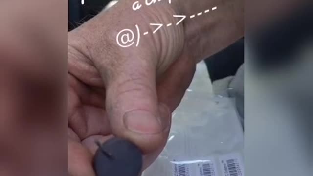 MICROCHIP in the needle