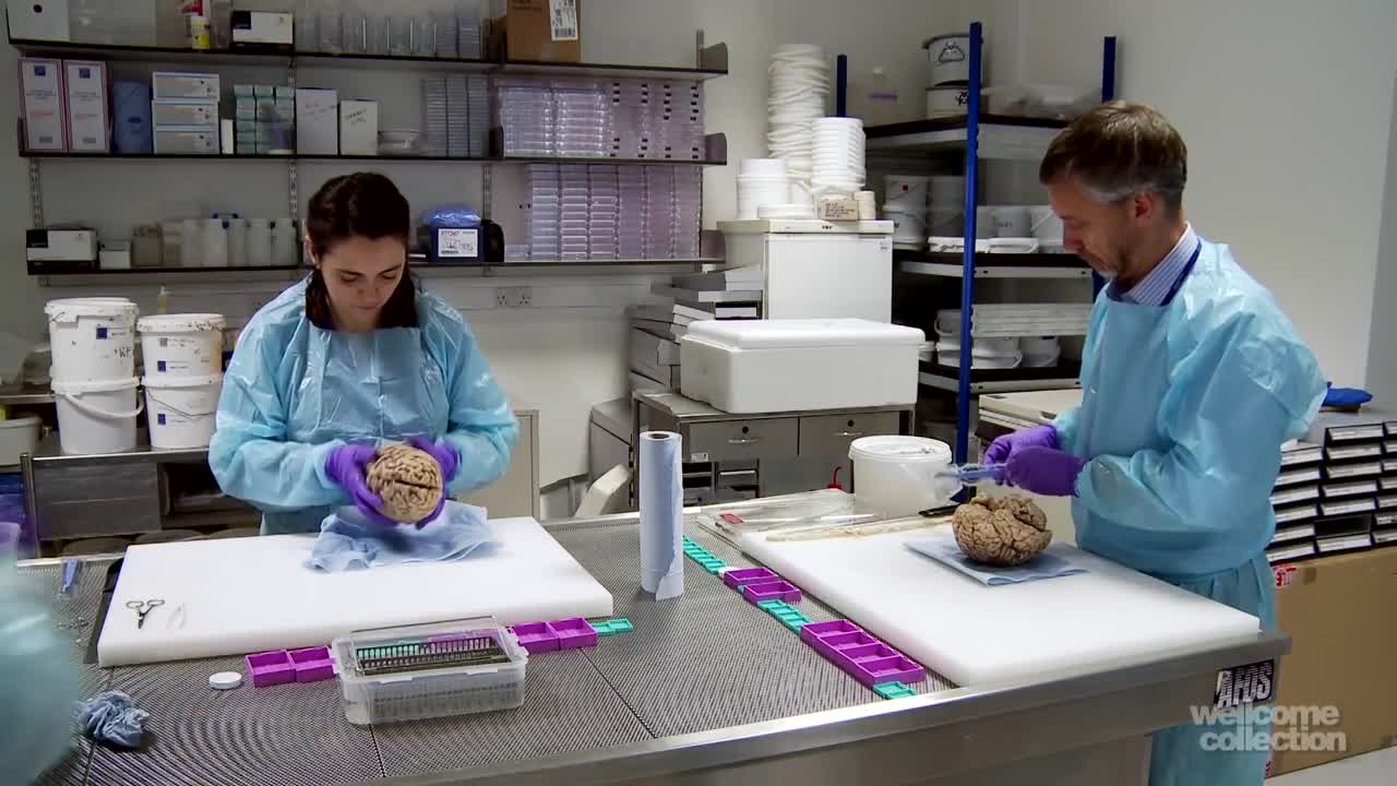 Cortes para amostras do tecido cerebral Dissecting Brains