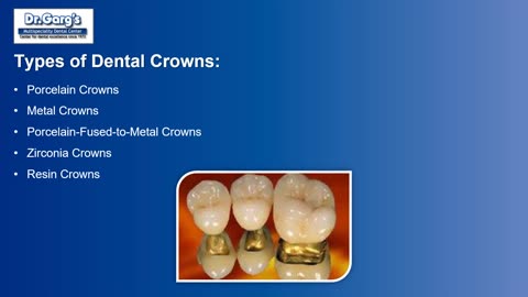 Durability Meets Beauty The Advantage of Dental Crowns