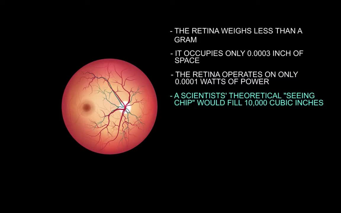 Unthinking natural processes couldn't make an eye