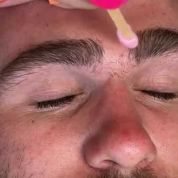 Satisfying Monobrow Transformation