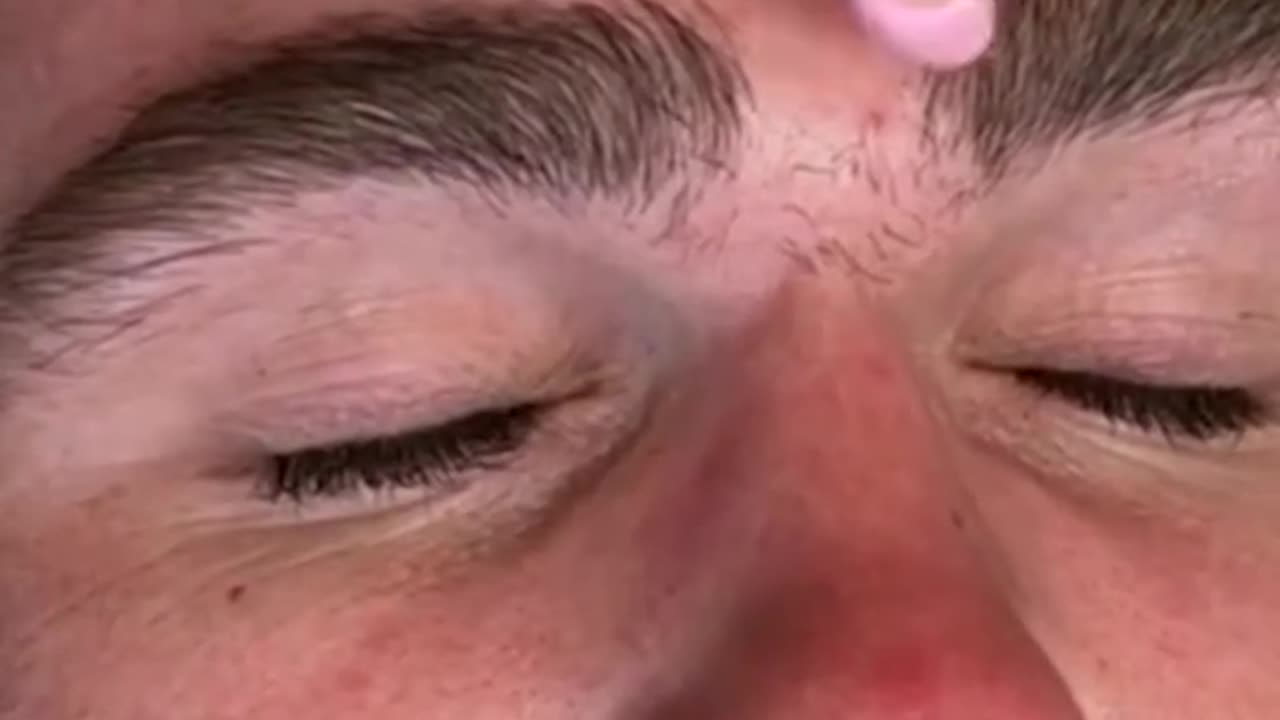 Satisfying Monobrow Transformation