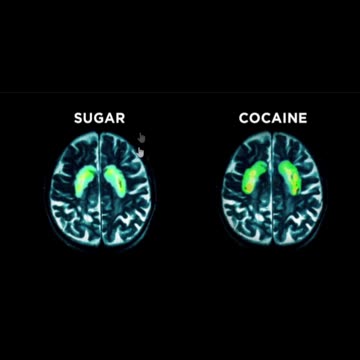 NEW Research: Sugar vs Cocaine #sugar #diabetes #addictionrecovery