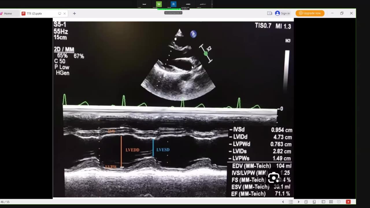 2nd lecture of basics of TTE