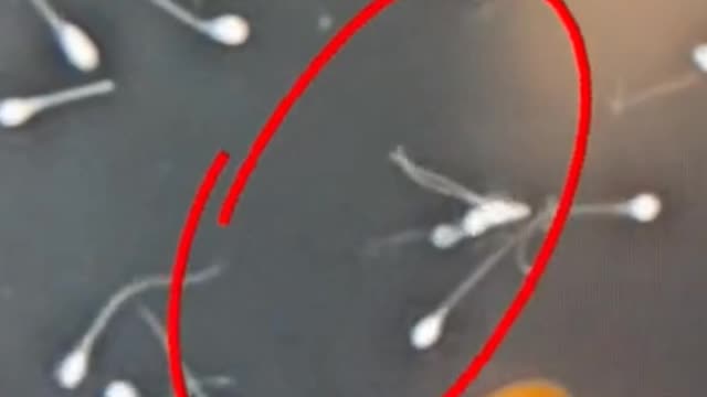 What kind of sperm is this | Viral Video on rumble