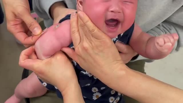 babies funnny crying vs doktor 0007 || baby cute crying