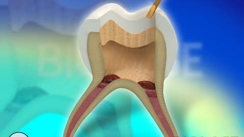 dental-restoration