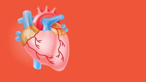 A blockage of blood flow to the heart muscle.