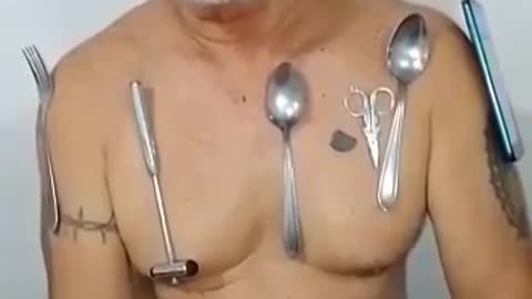 VICTIMA DE LA VACUNA DEL COVID 19 CON MAGNETISMO EN EL CUERPO
