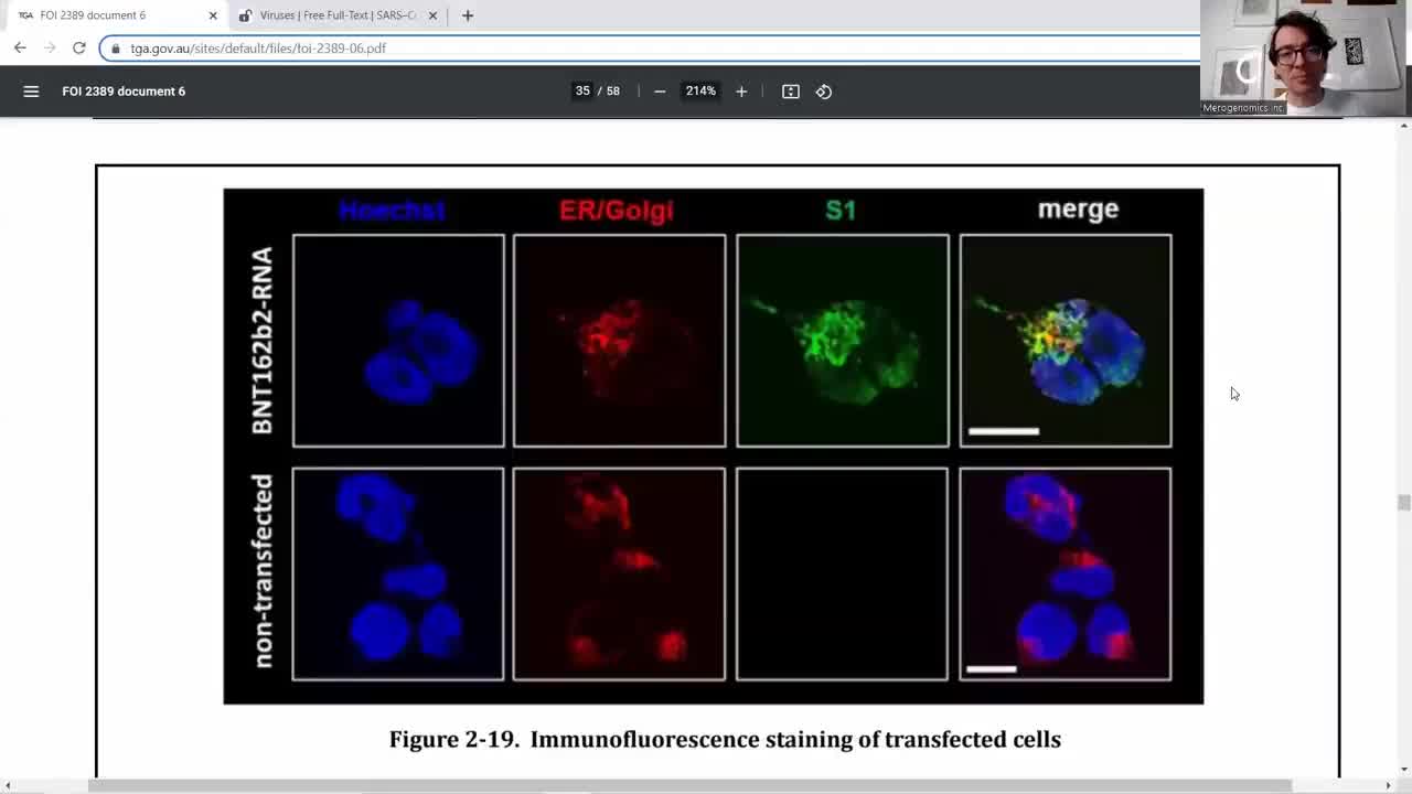 Pfizer Study: "Vaxx Spike Protein can Enter Cell Nucleus & Possibly Alter Genes"