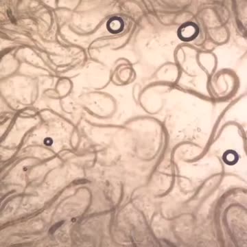 Onions vs Human Parasites