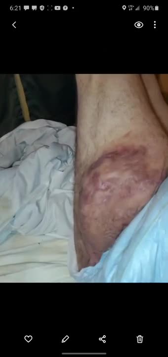 Leg Sour Slide Show (June 2020)