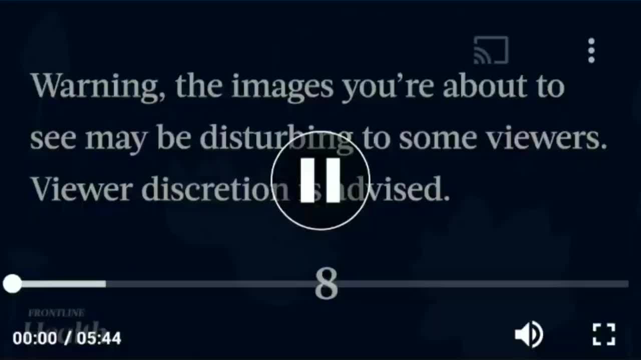Mystery Clots Appear in 50–70 Percent of Deceased: Funeral Director - Epoch Health Frontline