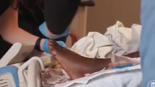 🇺🇸 NFL&MLB super star, Deion Sanders has largely pushed the vaXX. He now just had his toes amputated