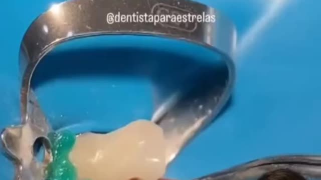 THAT'S inside your tooth