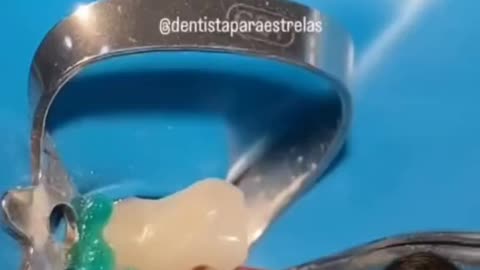 THAT'S inside your tooth