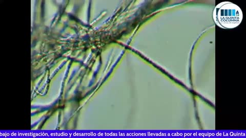 OTRA MIRADA AL MICROSCOPIO DE UNA KAKUNA PFIZER