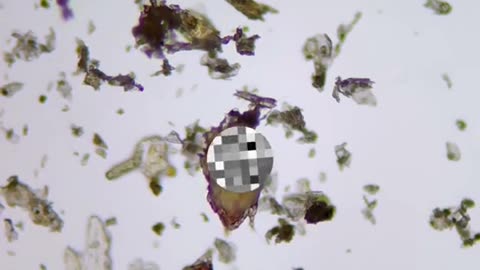 Becterya in microscope