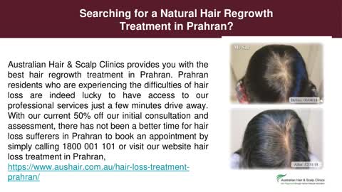 Natural Hair Loss Treatment Prahran