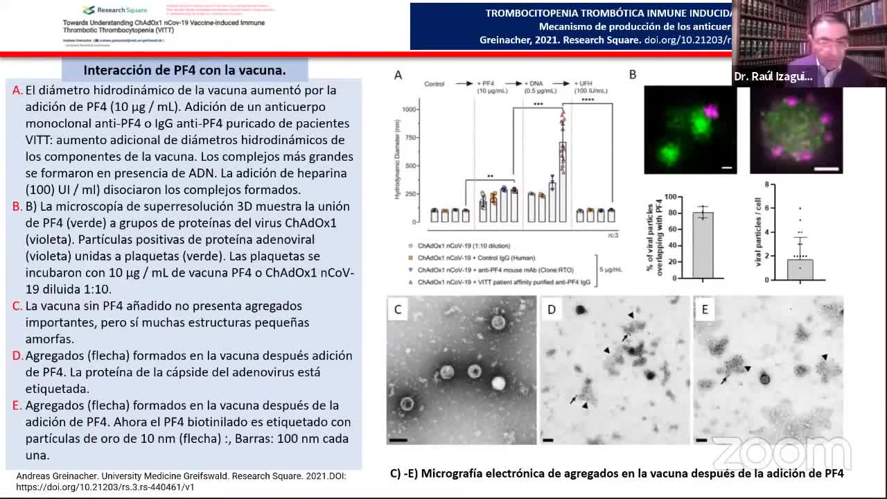 Trombocitopenia Trombótica Inmunitaria Inducida por Vacuna Trombosis de los senos venosos cerebrales