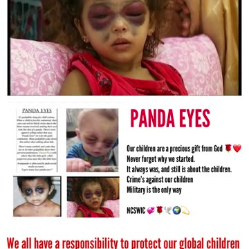 Panda Eyes - Media Silence is Complicity