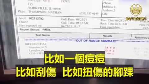 打了第二針後 中性粒細胞飆高(緊急反應類型的細胞) 這種細胞對組織損傷產生反應 換言之你的身體已經嚴重被損害
