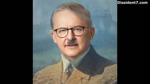 A Few More Funny Prime Minister Anthony Albanese Memes
