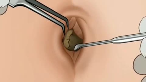 NAVEL CLEANING ASMR