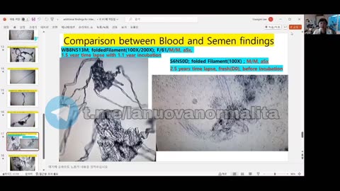 Dott.ssa Youngmi Lee ci racconta le sue nuove scoperte esclusive sui nanochip