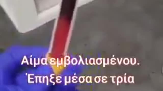 H βελονιαση θεραπευει