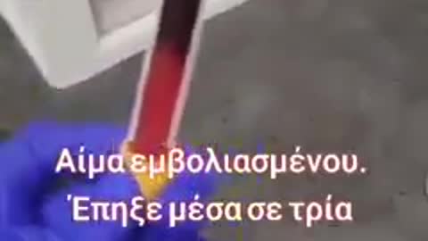 H βελονιαση θεραπευει