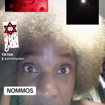 SICKLE CELL BLOOD BLOOD LINE DAVID