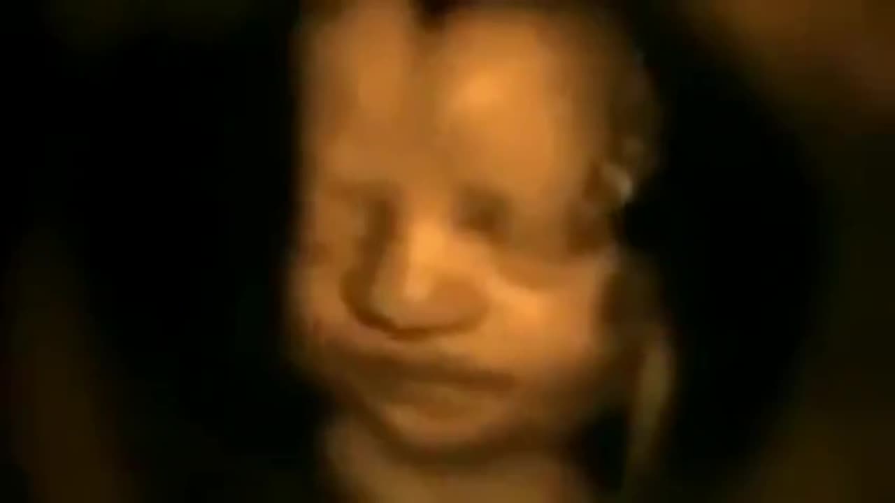 Scan Captured Footage Of What Unborn Babies Do In The Womb