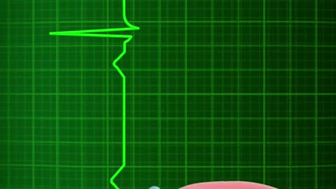 Sugar Shock Understanding the Effects of Excessive Sugar Intake