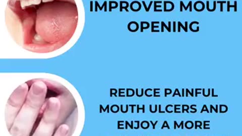 30 Minute Fast Treatment to Heal OSMF — OLI Therapy By Dr. Agravat