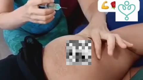 CDI aplicado diretamente no tumor
