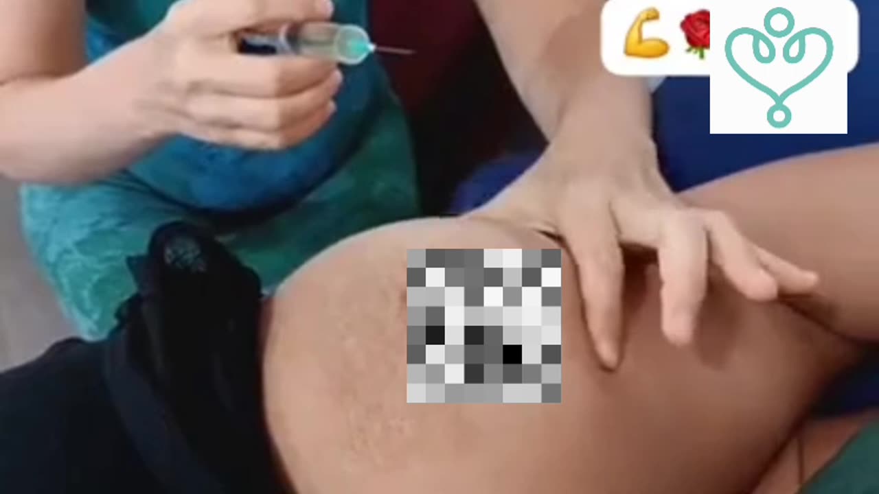 CDI aplicado diretamente no tumor