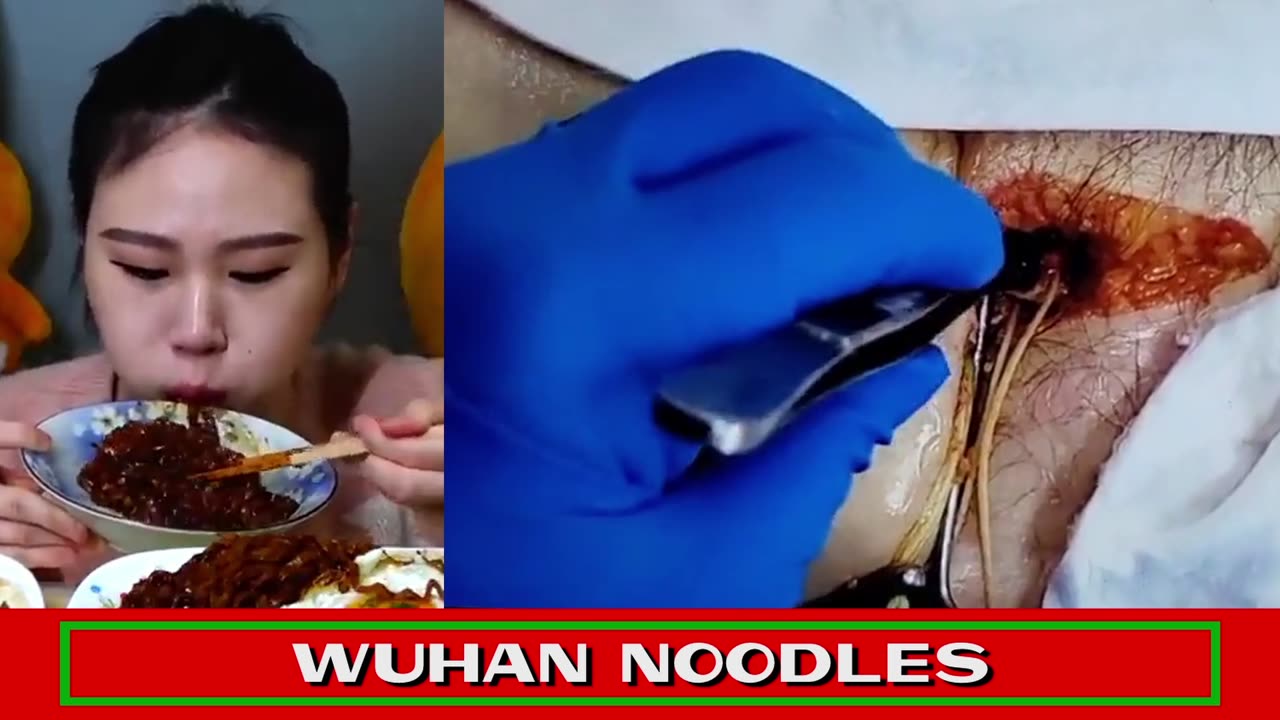 WUHAN NOODLES - Vaccine Blood Clots