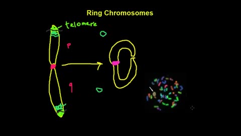 Gene expression