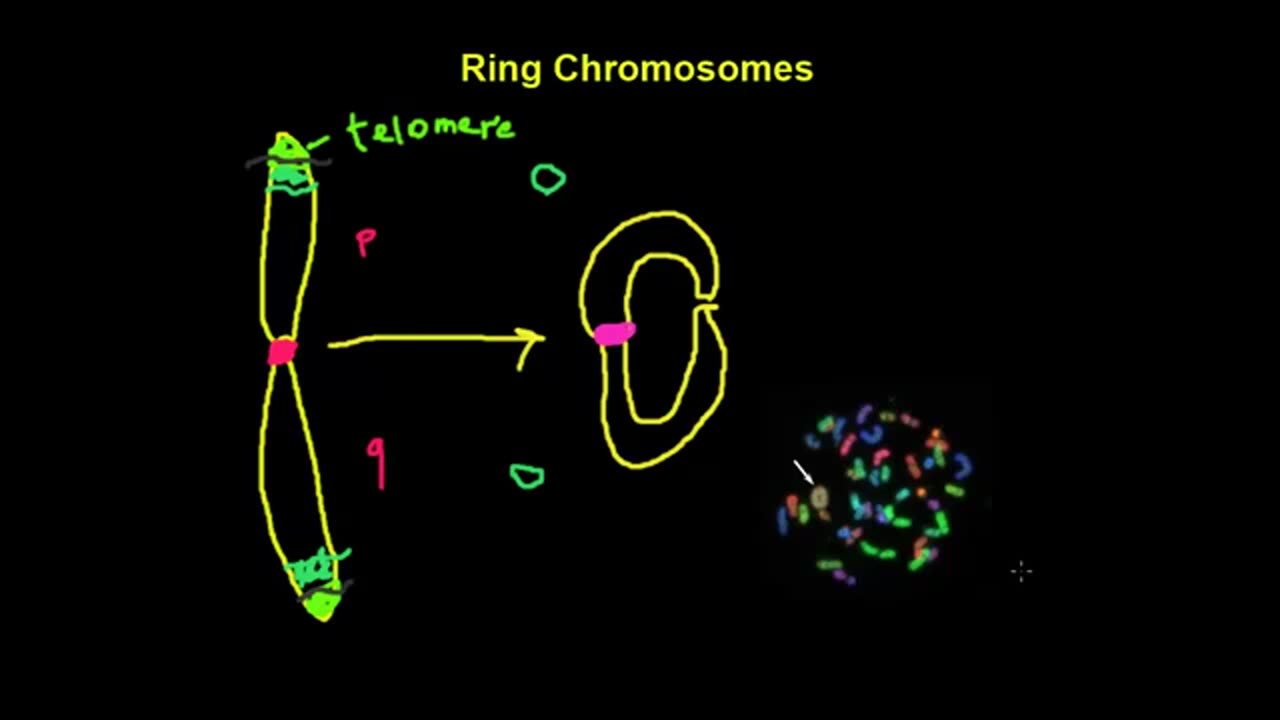 Gene expression