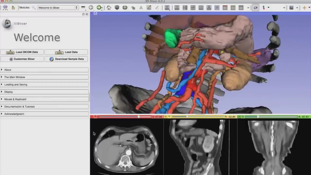 The Ultimate Operating Room