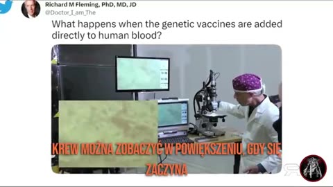 Obrazowanie Termograficzne Pokazuje Masywne Skrzepy Krwi u Bezobjawowych Zaszczepionych