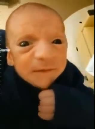 “真相正被紀錄”，接種mRNA新冠疫苗實驗針劑（C_19 vaccine）的父母，發現產下的新生兒（new born baby）的“奇怪特徵”！諾貝爾獎得主Dr.Luc…生前的擔憂“實驗針劑副作用”，影響三到五代…