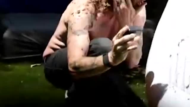 Jackass 4's Steve-O vsent to Hospital by SteveWillDoIt!!