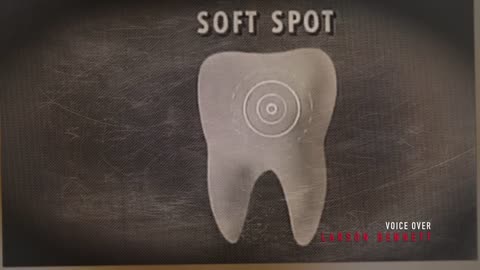 Fluoride Poison On Tap