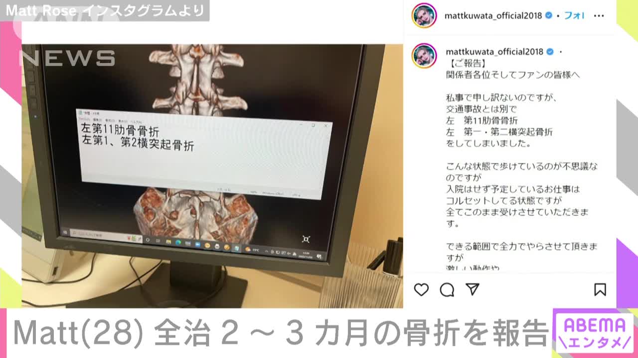 Matt 全治2～3カ月の骨折を報告 「こんな状態で歩けているのが不思議」 仕事は継続(2022年11月7日)